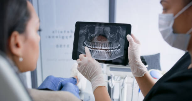 Licensed Teeth Whitening service in Vidor, TX - Smile Center Dentistry
